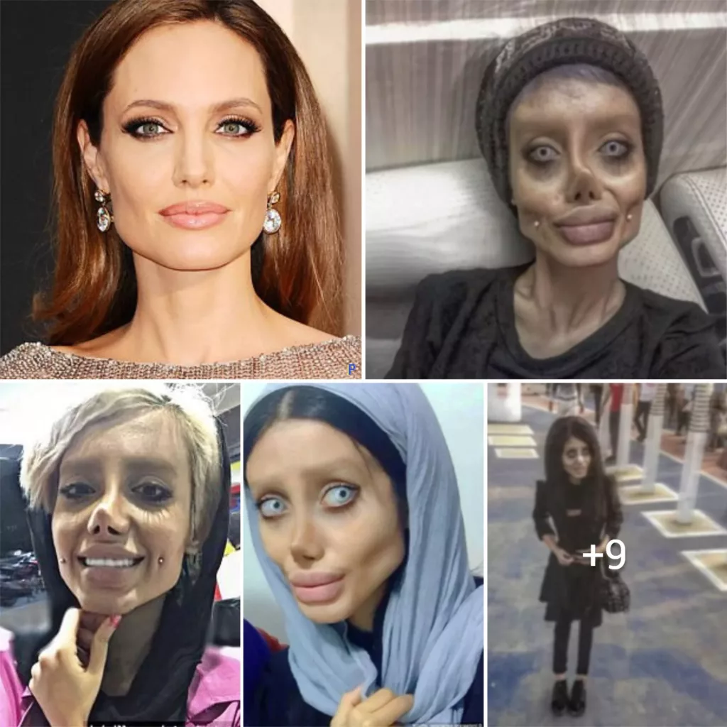 “The Amazing Metamorphosis of an Iranian Woman: Her Striking Resemblance to Angelina Jolie Raises Eyebrows with Rumors of Multiple Surgeries”